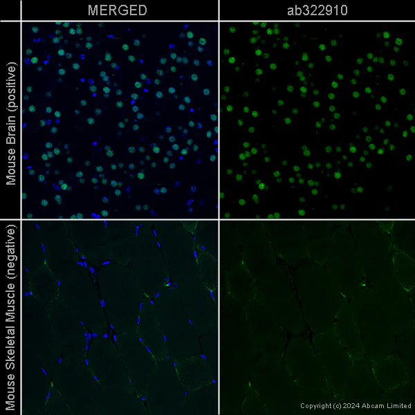 Immunohistochemistry (Formalin/PFA-fixed paraffin-embedded sections) - Anti-Ctip2 antibody [EPR23120-25] – Rat IgG2a (Chimeric) (AB322910)