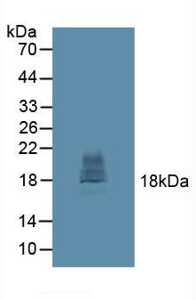 Western blot - Anti-CTLA4 antibody (AB231949)