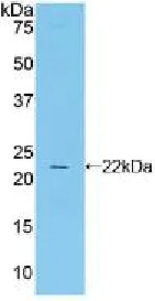 Western blot - Anti-CTLA4 antibody (AB231949)