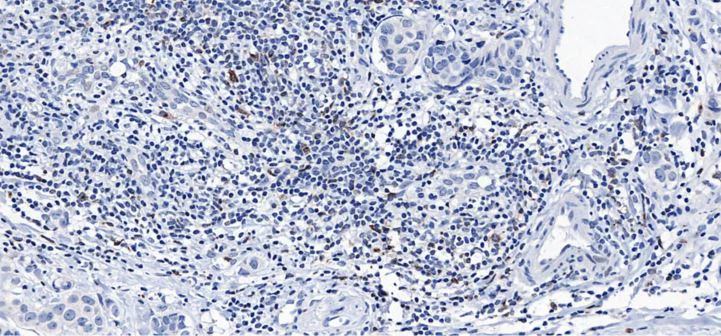 Immunohistochemistry (Formalin/PFA-fixed paraffin-embedded sections) - Anti-CTLA4 antibody [CAL49] (AB237712)