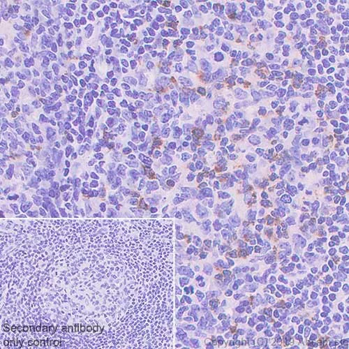Immunohistochemistry (Formalin/PFA-fixed paraffin-embedded sections) - Anti-CTLA4 antibody [CAL49] (AB237712)