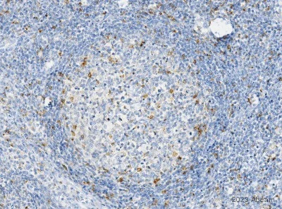 Immunohistochemistry (Formalin/PFA-fixed paraffin-embedded sections) - Anti-CTLA4 antibody [CAL49] (AB237712)