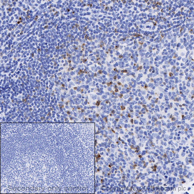 Immunohistochemistry (Formalin/PFA-fixed paraffin-embedded sections) - Anti-CTLA4 antibody [CAL49] (AB237712)