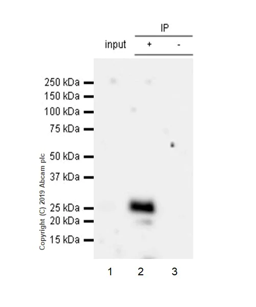 Immunoprecipitation - Anti-CTLA4 antibody [CAL49] (AB237712)