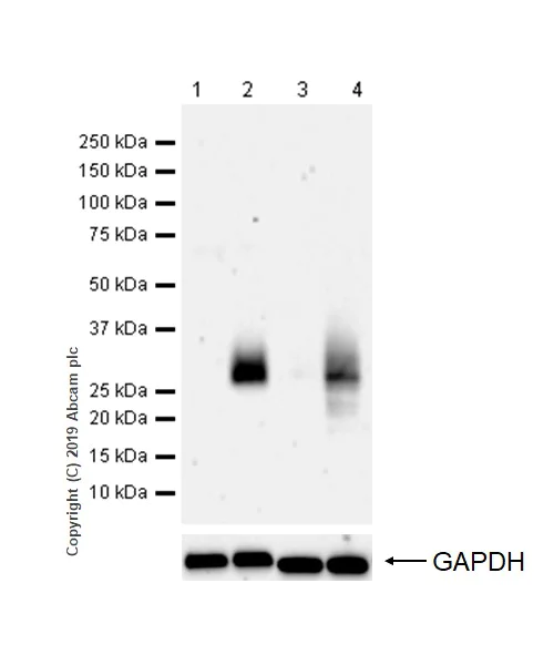 Western blot - Anti-CTLA4 antibody [CAL49] (AB237712)