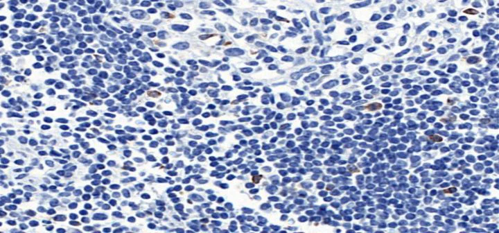 Immunohistochemistry (Formalin/PFA-fixed paraffin-embedded sections) - Anti-CTLA4 antibody [CAL49] - BSA and Azide free (AB251599)