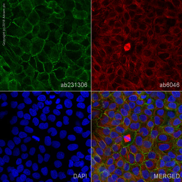 Immunocytochemistry/ Immunofluorescence - Anti-CTNNA1 antibody [1G5] (AB231306)