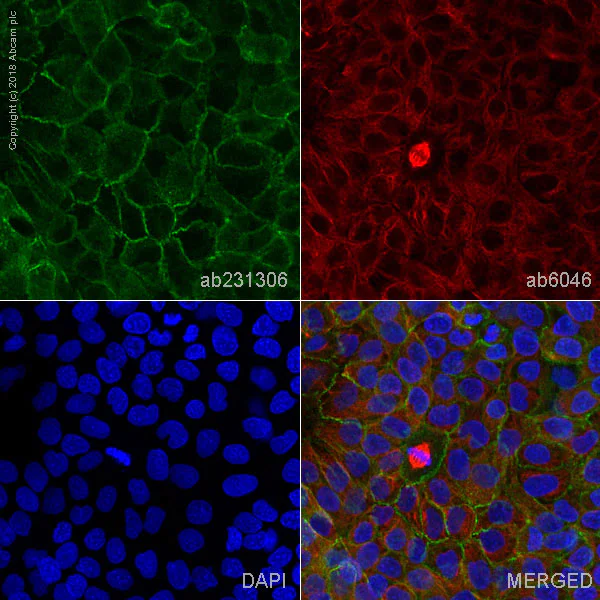 Immunocytochemistry/ Immunofluorescence - Anti-CTNNA1 antibody [1G5] (AB231306)
