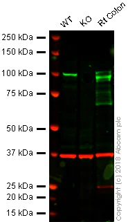 Western blot - Anti-CTNNA1 antibody [1G5] (AB231306)