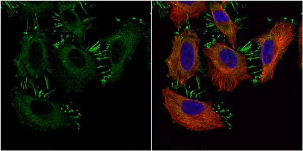 Immunocytochemistry/ Immunofluorescence - Anti-CTNNA1 antibody (AB227181)