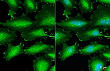 Immunocytochemistry/ Immunofluorescence - Anti-CTNNA1 antibody (AB227181)