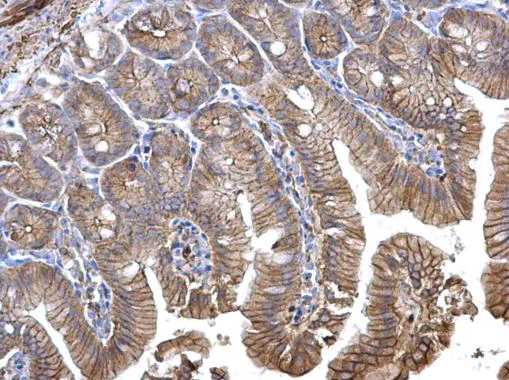 Immunohistochemistry (Formalin/PFA-fixed paraffin-embedded sections) - Anti-CTNNA1 antibody (AB227181)