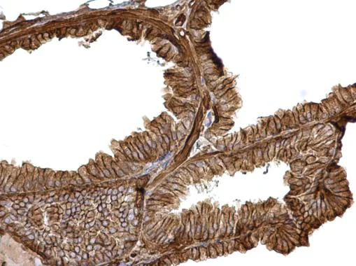 Immunohistochemistry (Formalin/PFA-fixed paraffin-embedded sections) - Anti-CTNNA1 antibody (AB227181)