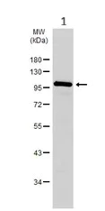 Western blot - Anti-CTNNA1 antibody (AB227181)