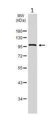 Western blot - Anti-CTNNA1 antibody (AB227181)