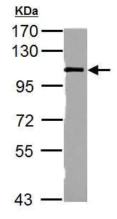 Western blot - Anti-CTNNA1 antibody (AB227181)