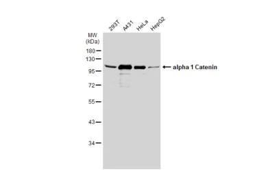 Western blot - Anti-CTNNA1 antibody (AB227181)