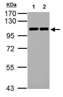 Western blot - Anti-CTNNA1 antibody (AB227181)