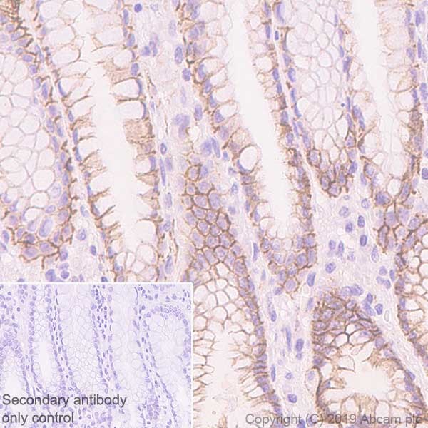 Immunohistochemistry (Formalin/PFA-fixed paraffin-embedded sections) - Anti-CTNNA1 antibody [EP1793Y] (AB51032), expandable thumbnail