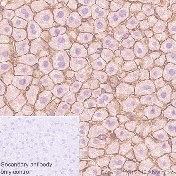 Immunohistochemistry (Formalin/PFA-fixed paraffin-embedded sections) - Anti-CTNNA1 antibody [EP1793Y] (AB51032), expandable thumbnail
