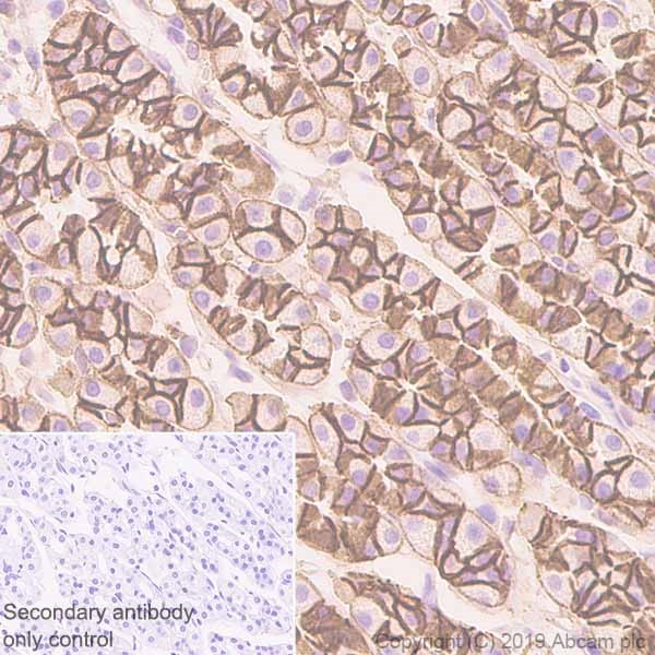 Immunohistochemistry (Formalin/PFA-fixed paraffin-embedded sections) - Anti-CTNNA1 antibody [EP1793Y] (AB51032), expandable thumbnail