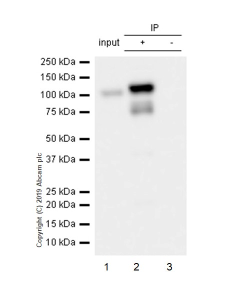 Immunoprecipitation - Anti-CTNNA1 antibody [EP1793Y] (AB51032), expandable thumbnail