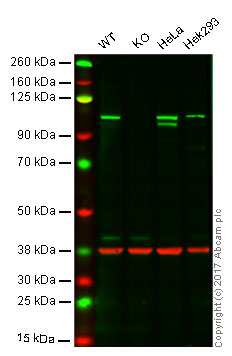 Western blot - Anti-CTNNA1 antibody [EP1793Y] (ab51032), expandable thumbnail