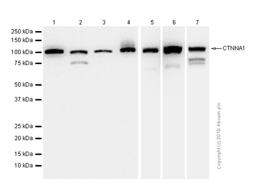 Western blot - Anti-CTNNA1 antibody [EP1793Y] (AB51032), expandable thumbnail