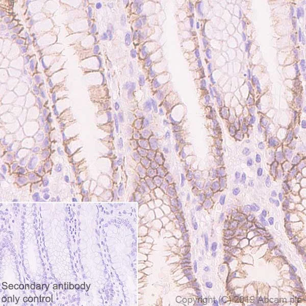 Immunohistochemistry (Formalin/PFA-fixed paraffin-embedded sections) - Anti-CTNNA1 antibody [EP1793Y] - Low endotoxin, Azide free (AB226010)