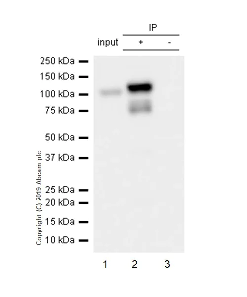Immunoprecipitation - Anti-CTNNA1 antibody [EP1793Y] - Low endotoxin, Azide free (AB226010)