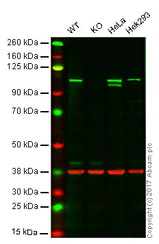 Western blot - Anti-CTNNA1 antibody [EP1793Y] - Low endotoxin, Azide free (AB226010)