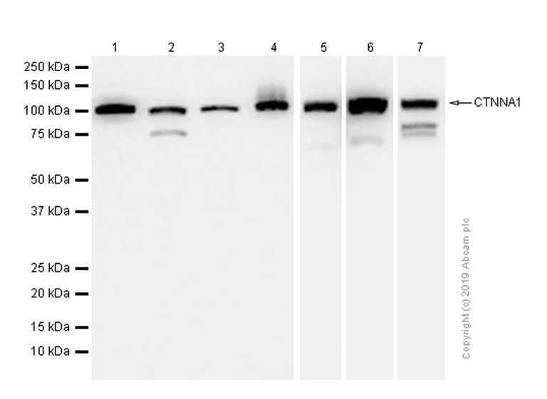 Western blot - Anti-CTNNA1 antibody [EP1793Y] - Low endotoxin, Azide free (AB226010)