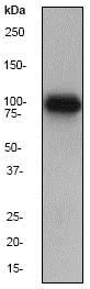 Western blot - Anti-CTNNA2 antibody [EPR1795] - BSA and Azide free (AB247430)