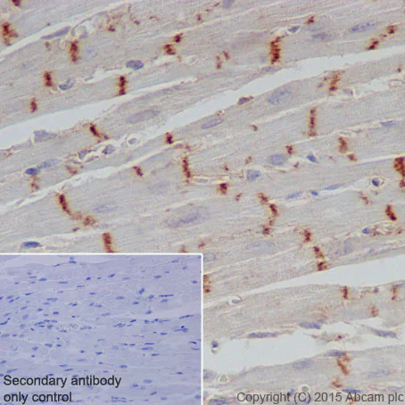 Immunohistochemistry (Formalin/PFA-fixed paraffin-embedded sections) - Anti-CTNNA3 antibody [EPR18307] (AB184916)