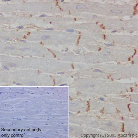 Immunohistochemistry (Formalin/PFA-fixed paraffin-embedded sections) - Anti-CTNNA3 antibody [EPR18307] (AB184916)