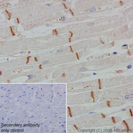 Immunohistochemistry (Formalin/PFA-fixed paraffin-embedded sections) - Anti-CTNNA3 antibody [EPR18307] (AB184916)
