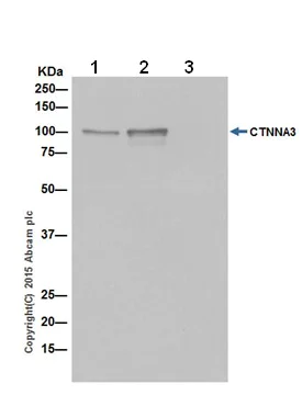 Immunoprecipitation - Anti-CTNNA3 antibody [EPR18307] (AB184916)