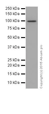 Western blot - Anti-CTNNA3 antibody [EPR18307] (AB184916)