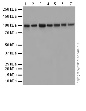 Western blot - Anti-CTNNA3 antibody [EPR18307] (AB184916)