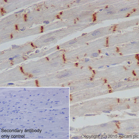 Immunohistochemistry (Formalin/PFA-fixed paraffin-embedded sections) - Anti-CTNNA3 antibody [EPR18307] - BSA and Azide free (AB250780), expandable thumbnail