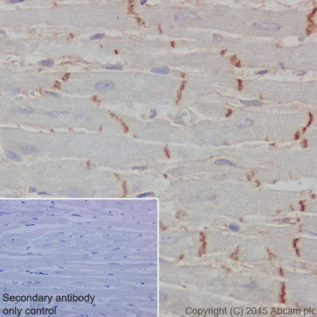 Immunohistochemistry (Formalin/PFA-fixed paraffin-embedded sections) - Anti-CTNNA3 antibody [EPR18307] - BSA and Azide free (ab250780), expandable thumbnail