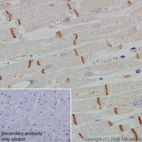 Immunohistochemistry (Formalin/PFA-fixed paraffin-embedded sections) - Anti-CTNNA3 antibody [EPR18307] - BSA and Azide free (AB250780), expandable thumbnail