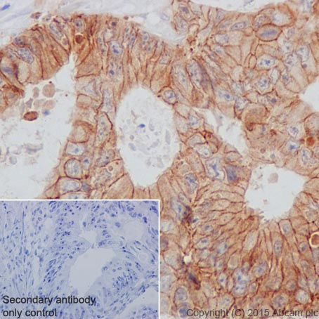 Immunohistochemistry (Formalin/PFA-fixed paraffin-embedded sections) - Anti-CTNNA3 antibody [EPR18307] - BSA and Azide free (AB250780), expandable thumbnail