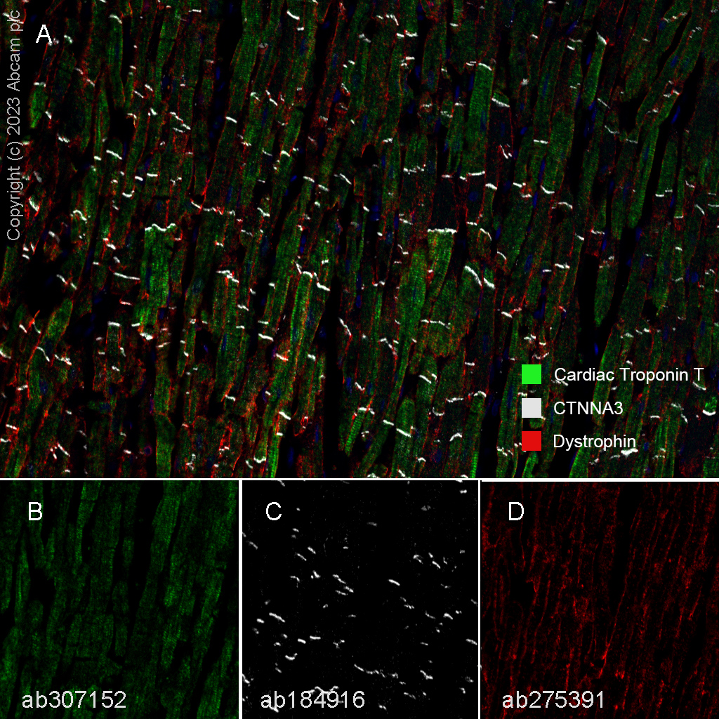 Multiplex immunohistochemistry - Anti-CTNNA3 antibody [EPR18307] - BSA and Azide free (ab250780), expandable thumbnail
