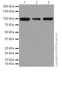 Western blot - Anti-CTNNA3 antibody [EPR18307] - BSA and Azide free (AB250780), expandable thumbnail