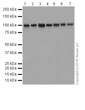 Western blot - Anti-CTNNA3 antibody [EPR18307] - BSA and Azide free (ab250780), expandable thumbnail