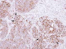 Immunohistochemistry (Formalin/PFA-fixed paraffin-embedded sections) - Anti-CTNNAL1 antibody (AB96184), expandable thumbnail