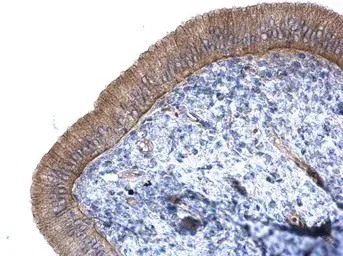Immunohistochemistry (Formalin/PFA-fixed paraffin-embedded sections) - Anti-CTNNAL1 antibody (AB96184)