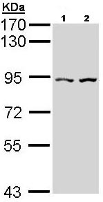 Western blot - Anti-CTNNAL1 antibody (AB96184), expandable thumbnail