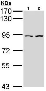 Western blot - Anti-CTNNAL1 antibody (AB96184)